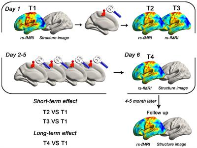 Predicting Long-Term After-Effects of Theta-Burst Stimulation on Supplementary Motor Network Through One-Session Response